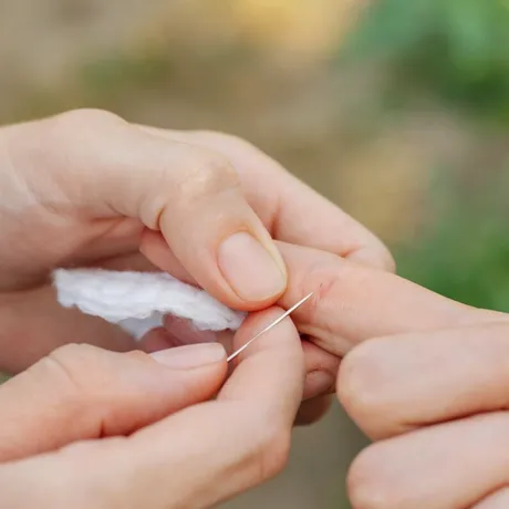 Cum scoți o așchie din deget rapid. Trucul viral pe care trebuie să-l încerci / VIDEO