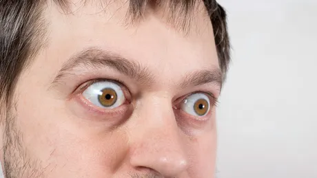 8 boli care ți se citesc în privire. Ce semne dau ochii când ai un AVC sau probleme cu ficatul ori tiroida