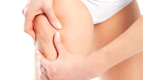 Am demontat miturile despre celulită - VIDEO by CSID