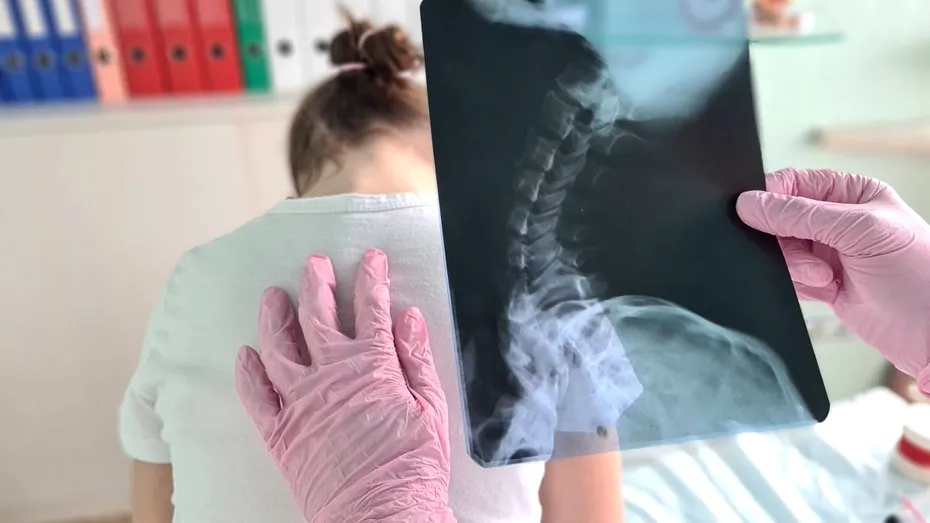 Cum afectează telefonul postura copiilor. Osteopat: „Lipsa mișcării este cauza reală, nu telefonul în sine”