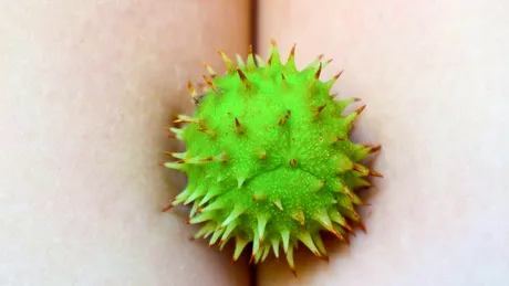 Hemoroizii - sfaturi privind alimentația și metode de tratament în funcție de stadiul bolii