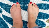 Semnele ascunse de pe picioare care pot indica probleme grave de sănătate. La ce trebuie să fii atent