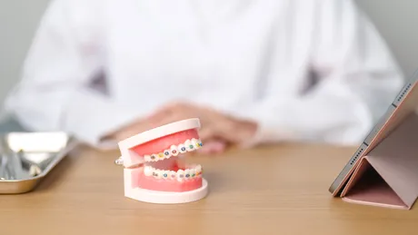 Cum putem preveni purtarea aparatelor dentare