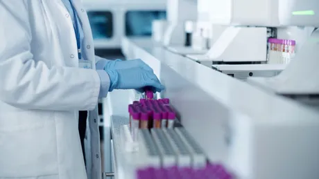 Noul test de sânge care ar putea estima riscul de deces în următorii ani