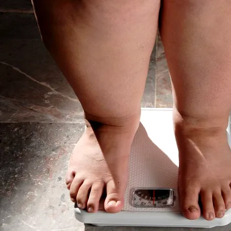 3,95 milioane de români suferă de obezitate. „Vorbim despre o adevărată pandemie a obezității la nivel mondial”