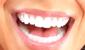 Dinţi albi – cum îi poţi avea?