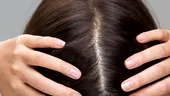 Părul gras: cum să scapi de această problemă, pe lângă șamponul uscat