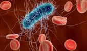 Infecţia cu E.coli – simptome, cauze, tratament