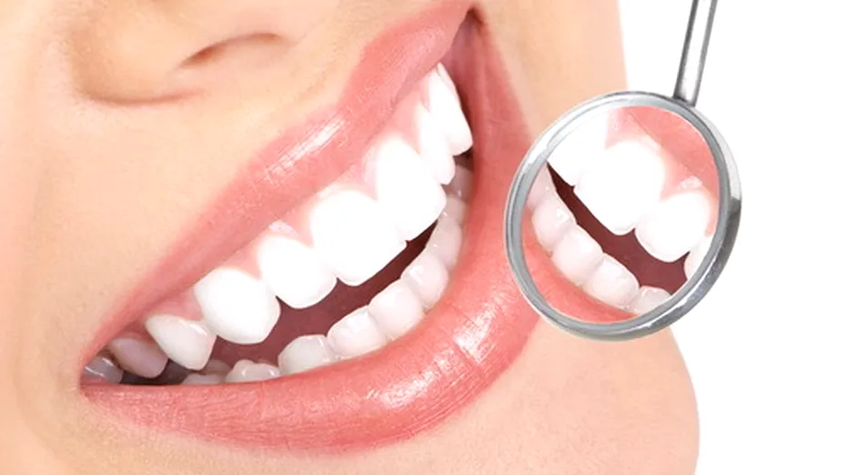 Albirea dentară în cabinetul stomatologic