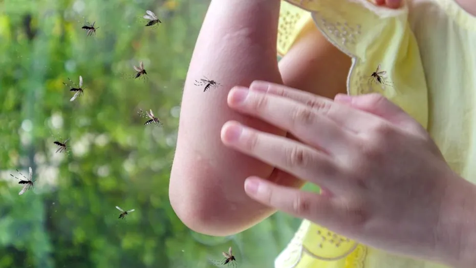 (P) Cum să ameliorezi mâncărimea şi inflamaţia după înţepăturile de insecte