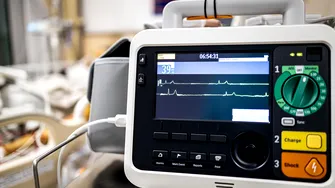 Puls sub 60 de bătăi pe minut? Cardiologii explică când este perfect normal și când poate ascunde o problemă de ritm cardiac