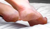Trucul uimitor pentru călcâie fine. Ai nevoie de un singur ingredient, iar până mâine pielea ta va fi mătăsoasă