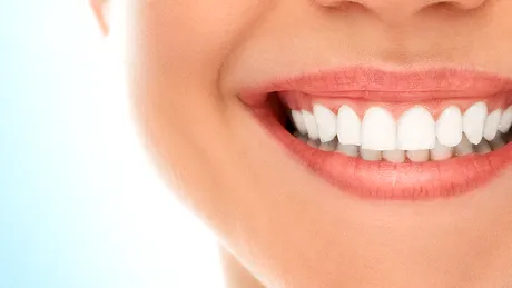 Vrei să-ţi albeşti dintii? Iată 8 lucruri pe care nu le ştiai
