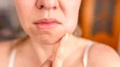 Ce se întâmplă cu dinții și gingiile în timpul menopauzei. Explicațiile medicului stomatolog