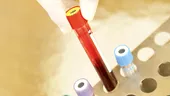 Când ţi-ai făcut ultima dată analizele de sânge?