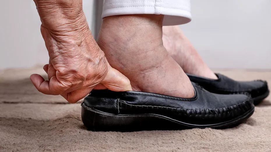 Semnele inimii bolnave care nu se simt în piept. Cum sunt afectate picioarele