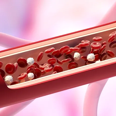Semne de colesterol crescut pe degetul mic și inelar. La ce să te uiți, de fapt