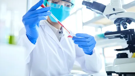 Un nou test poate depista cancerul de prostată!