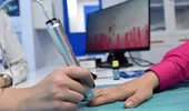 Vă amorțesc mâinile la frig? Investigația recomandată pentru diagnostic