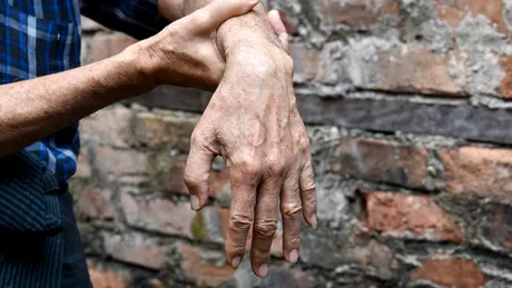 Spasticitatea după AVC: complicația care poate fi ținută sub control dacă este recunoscută la timp. „Dacă întârziem tratamentul, pot apărea contracturi permanente”