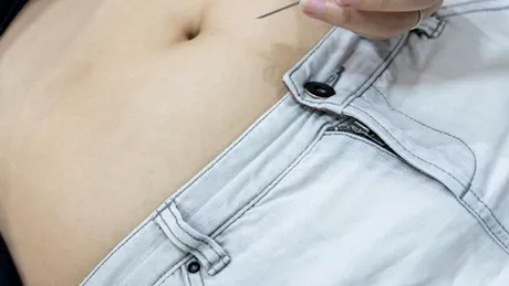 Hipogonadismul hipogonadotrop (deficit de gonadotropină): simptome, cauze, tratament