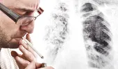 Ce pățesc plămânii dacă fumezi „doar” o țigară pe zi. Riscurile pe care fumătorii le ignoră
