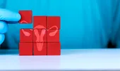 Fumatul poate agrava simptomele PMOS. Medicii explică de ce renunțarea la țigări este un pas important în controlul afecțiunii