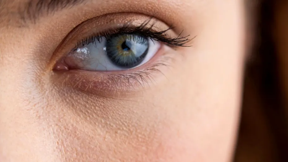 Ce semne dau ochii când ai probleme cu ficatul sau tiroida. Bolile care ți se citesc în privire