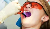 Dinţii cariaţi ar putea fi reparaţi cu ajutorul celulelor stem