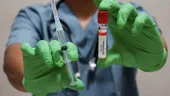 Vaccinul împotriva zonei zoster ar putea reduce riscul de infarct și AVC. Ce arată un nou studiu