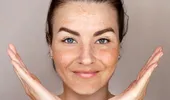 De ce poți avea pete pigmentare chiar dacă folosești cremă cu SPF