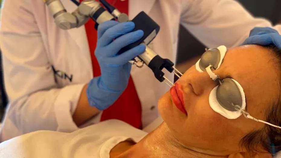 Tratamentul laser: cum îți întinerește pielea