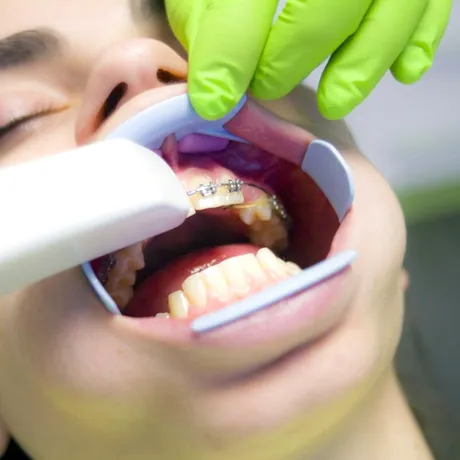 Inovații în tratamentul ortodontic. De la diagnostic la aparate dentare care reduc durata de tratament cu minimum șase luni