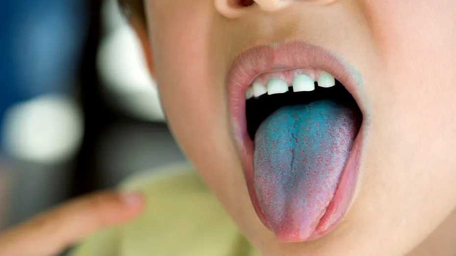 Albastru de metilen: beneficii, efecte adverse, contraindicații