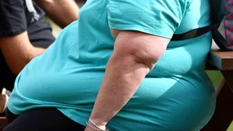 Diagnosticul de obezitate înainte de 30 de ani crește riscul de moarte prematură cu 70%