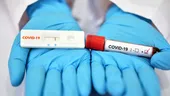 STUDIU: Testele rapide antigen depistează doar jumătate din cazurile asimptomatice de COVID