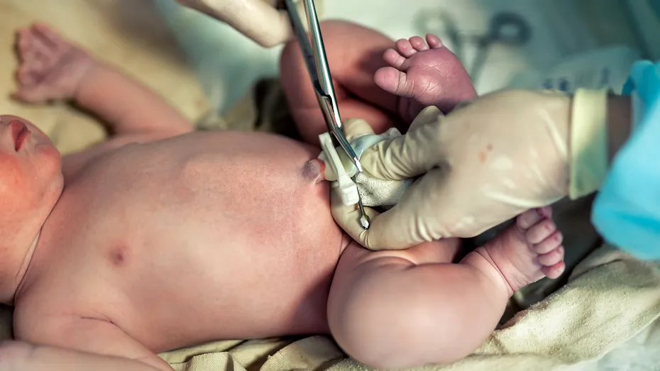 Clamparea întârziată a cordonului ombilical și recoltarea de celule stem la naștere: beneficii pentru bebeluș și pentru mamă