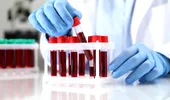 Boala Crohn ar putea fi depistată cu 10 ani înainte de diagnostic. Ce a dezvăluit un studiu recent