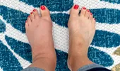 Semnele ascunse de pe picioare care pot indica probleme grave de sănătate. La ce trebuie să fii atent