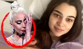 Boala groaznică de care suferă Theo Rose. Lady Gaga a avut aceeași problemă ca vedeta Pro TV