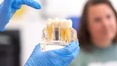 (P) Cum afecteaza diabetul succesul implanturilor dentare