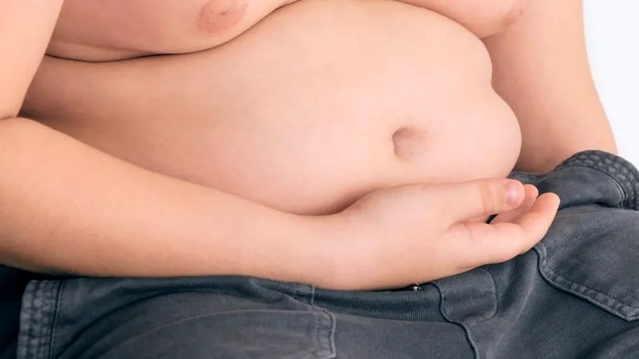 Obezitatea la copii: cauze şi reguli pentru prevenirea îngrăşării copiilor