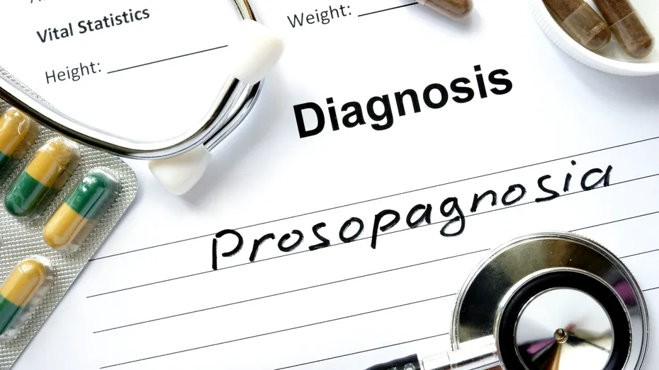 Prosopagnozia: ce este și cum se manifestă această boală rară  