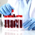 Boala Crohn ar putea fi depistată cu 10 ani înainte de diagnostic. Ce a dezvăluit un studiu recent