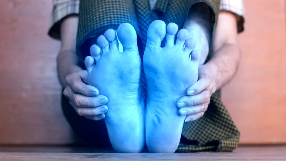 Îți amorțesc picioarele, te dor, sunt reci și umflate? Sunt semnale de alarmă că trebuie să iei măsuri URGENT!