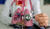 Tusea care nu dispare și lipsa de aer pot ascunde o boală pulmonară gravă. Semnele pe care nu ar trebui să le ignori