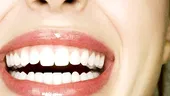 Dinţi frumoşi şi sănătoşi: faţete sau plombe?