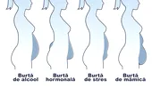 4 tipuri de burtă, în funcție de formă: care sunt cauzele și soluțiile lor