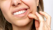Durerile de dinți în sezonul rece: reguli de bun simț care te scapă de sensibilitatea dentară