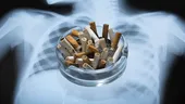 Cum să-ți cureți plămânii după ce te-ai lăsat de fumat. Primul lucru care se întâmplă în corp după ultima țigară